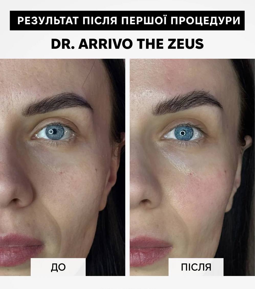 Dr. Arrivo Zeus IV