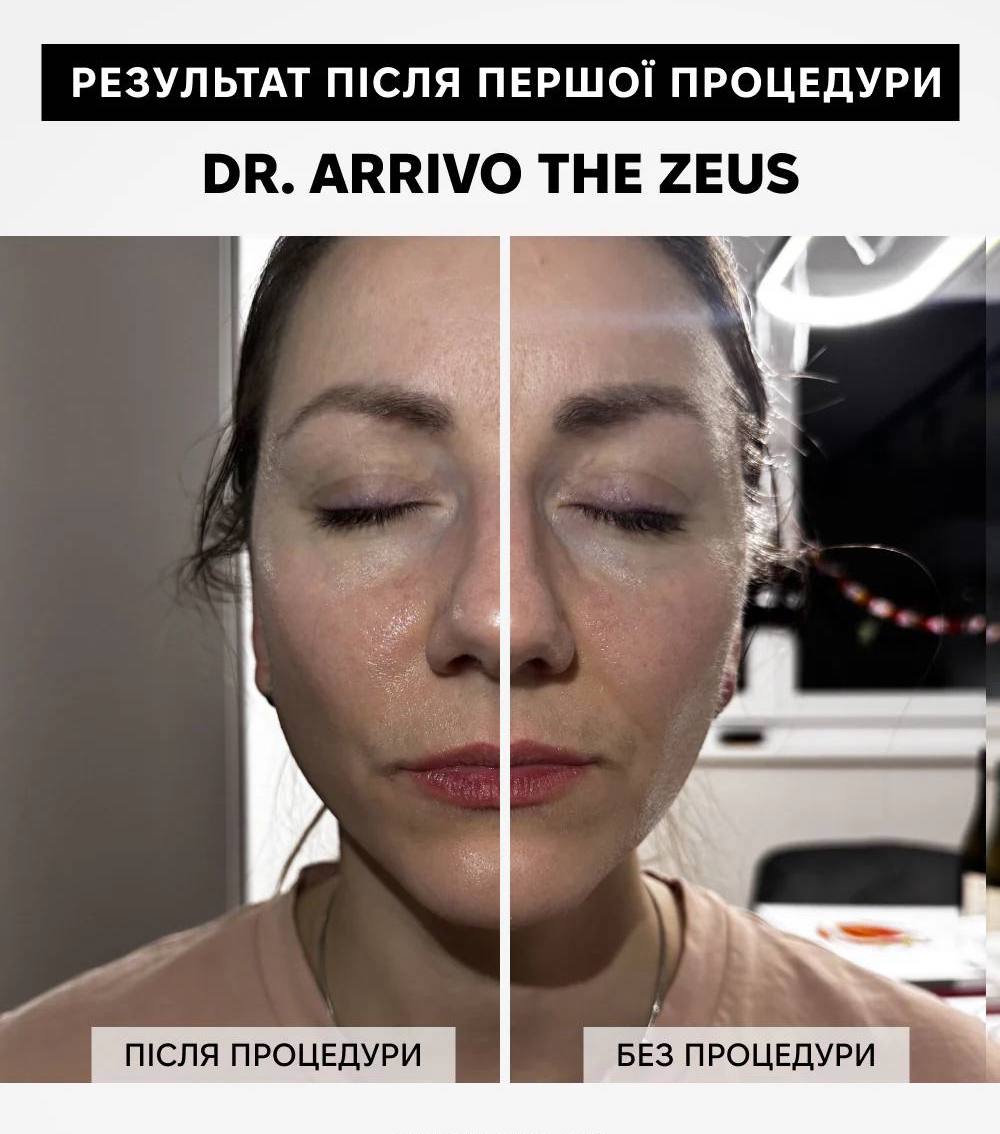 Dr. Arrivo Zeus IV